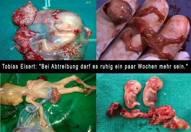 Tobias Eisert und donum vitae Boppard zur novellierung Paragraf 218 bzw. Schwangerschaftskonflikt Abtreibung